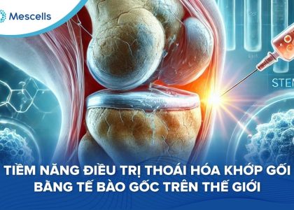 Tiềm năng điều trị thoái hóa khớp gối bằng tế bào gốc